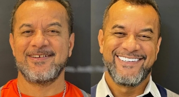 Servidor público morre ao colocar facetas dentárias em Goiânia – PC investiga